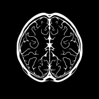 Non Wilsonian Hepatolenticular Degeneration Radiology