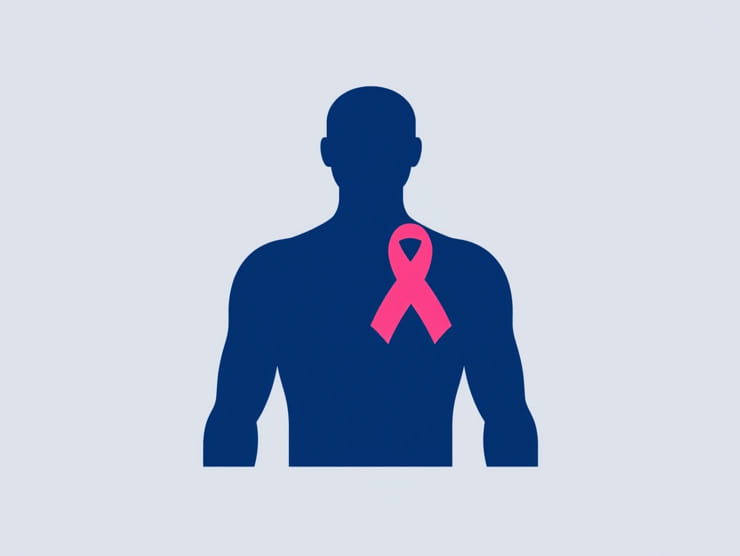 Of Male Breast Cancer