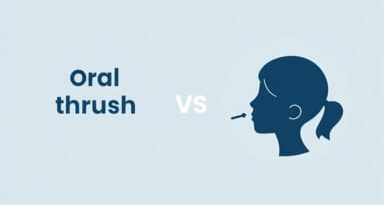 Oral Thrush Vs Tonsillitis
