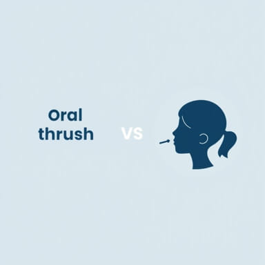 Oral Thrush Vs Tonsillitis