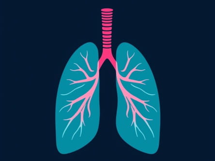 Pulmonary Fibrosis Rapid Deterioration