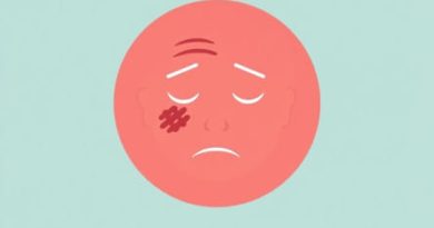 Recrudescence Of Stroke Symptoms