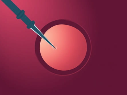 Surgical Puncture Of The Amniotic Sac