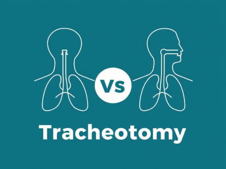 Tracheostomy Vs Tracheotomy Difference
