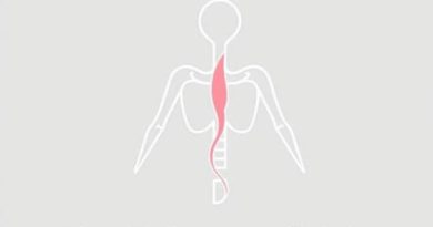 What Is The Cure For Rheumatism