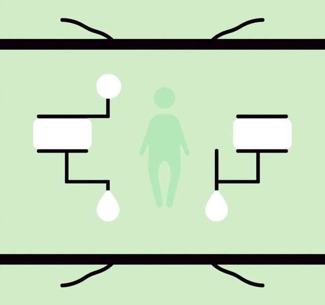 A Mild Systemic Disease