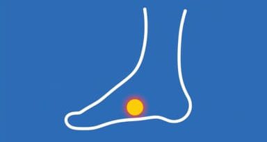 Cure For Plantar Fasciitis