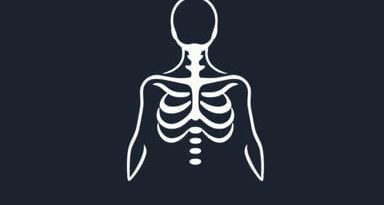 Do Gist Tumors Metastasize