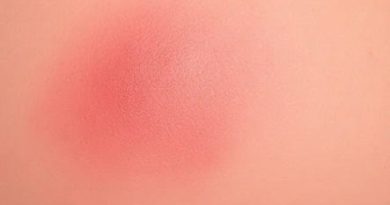 Erythema Toxicum Vs Pustular Melanosis