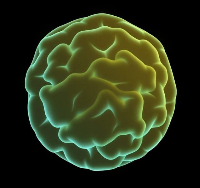 High Grade Glial Neoplasm