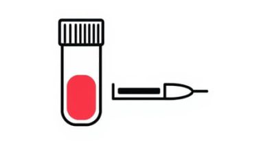 How Are The Results Of A Dipstick Urinalysis Determined?