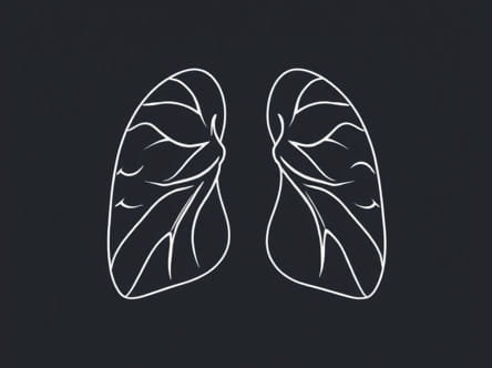 Most Common Cause Of Septal Perforation