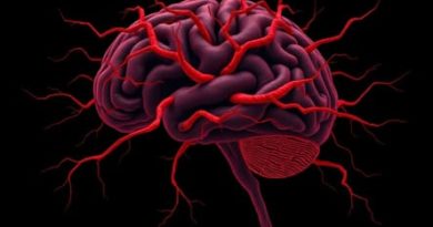 Myoclonic Epilepsy With Ragged Red Fibers