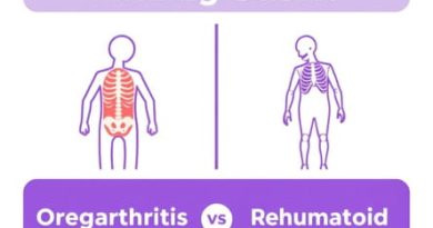 Osteoarthritis Vs Rheumatoid Arthritis Morning Stiffness