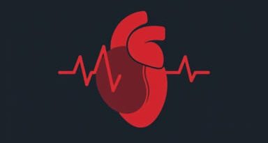 Qt Prolongation Myocardial Infarction