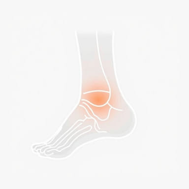 Sprained Medial Ligament Ankle