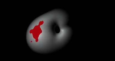 Unexplained Bruising In Groin Area