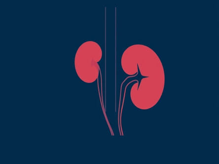 Where Does Renal Cancer Metastasize To