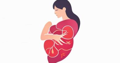 Gallbladder Pain Location Female