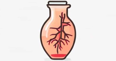 Jugular Vein Distention Indicates