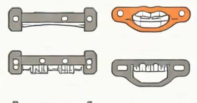 How Much Is A Bracket On Braces