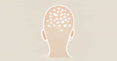 Scalp Eczema Treatment At Home