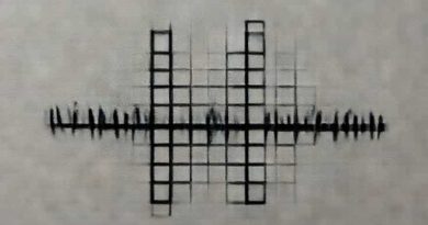 Tiny Undulation Crossword Clue