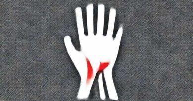 Ulnar Collateral Ligament Tear