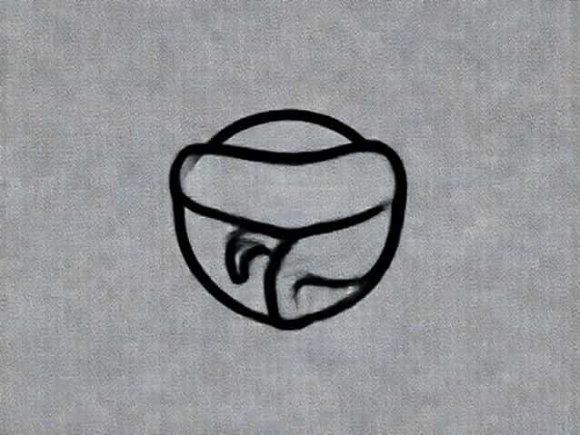 What Is Emphysematous Cystitis