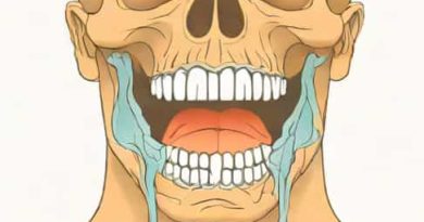 X Ray View For Maxillary Sinus