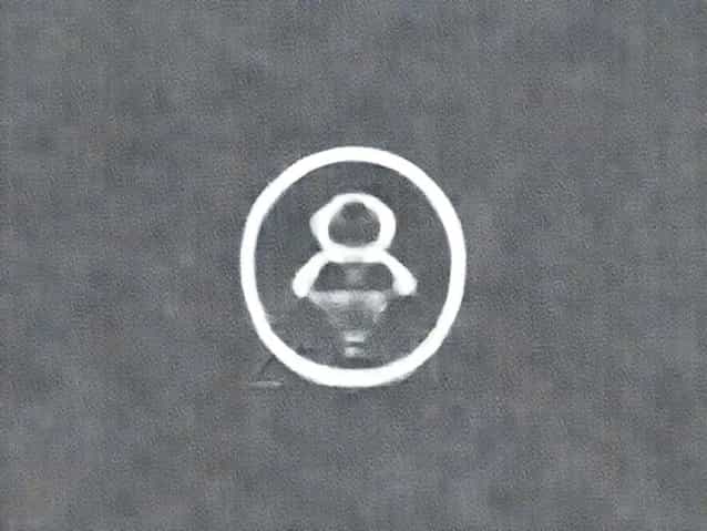 Zofran For Vestibular Neuritis