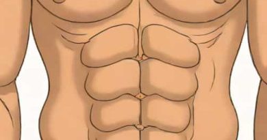 Diastases Of The Rectus Abdominis Musculature