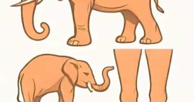 Difference Between Lymphedema And Elephantiasis