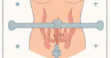 Epispadias Or Hypospadias Is Corrected Surgically With A