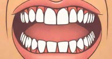 Excessive Protrusion Of The Maxillary Incisors Quizlet