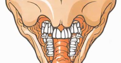 The Following Is A Voiceless Alveolar Lateral Fricative
