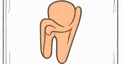 What Is Snipped When A Vasectomy Is Performed