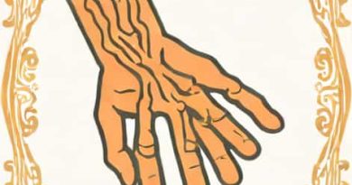 Which Is Worse Osteoarthritis Or Rheumatoid Arthritis