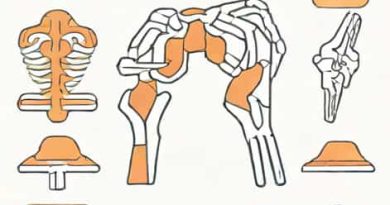 Which Of The Following Joints Is Cartilaginous