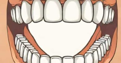 Embrasure Of Anterior Teeth