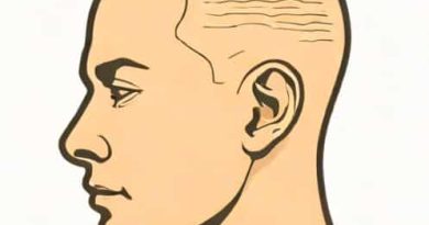 Grown Out Bleached Buzz Cut