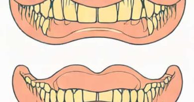 Is Maxillary Upper Or Lower
