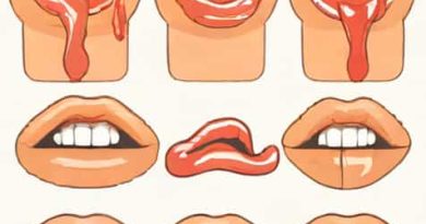 The Stages Of A Canker Sore