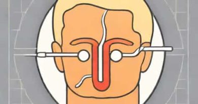 Xanax For Sinus Tachycardia